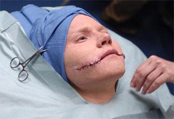 Nip/Tuck – Terza serie